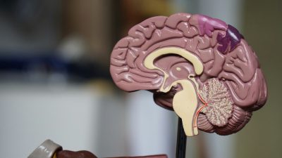 Split screen showing traditional X-ray reading versus AI-enhanced diagnostic visualization